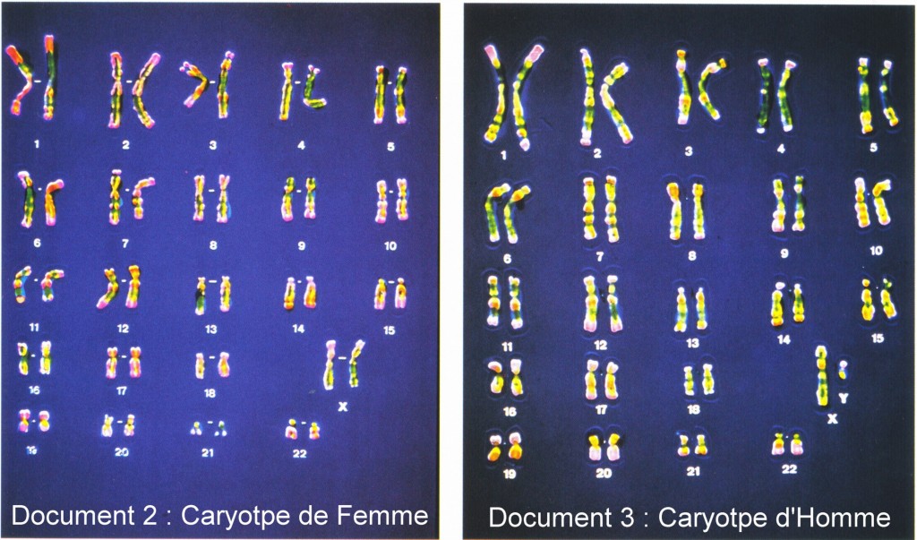 caryotype homme femme